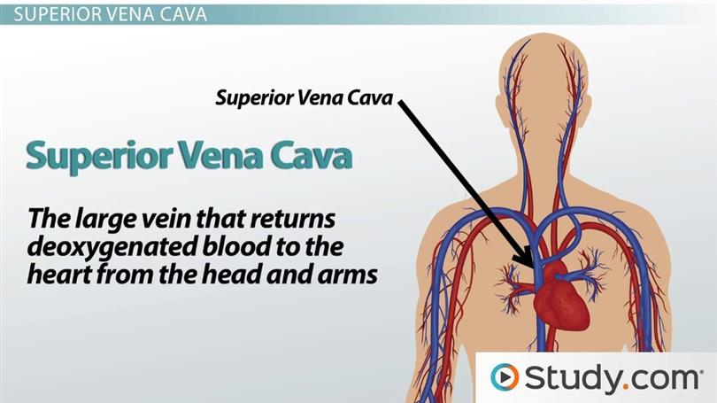 What Is Superior Vena Cava Syndrome